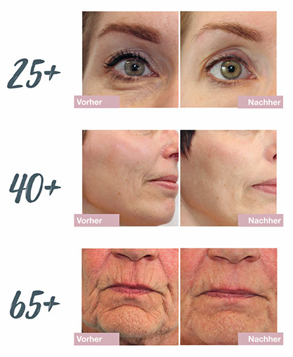 Dermatude Meta Therapy